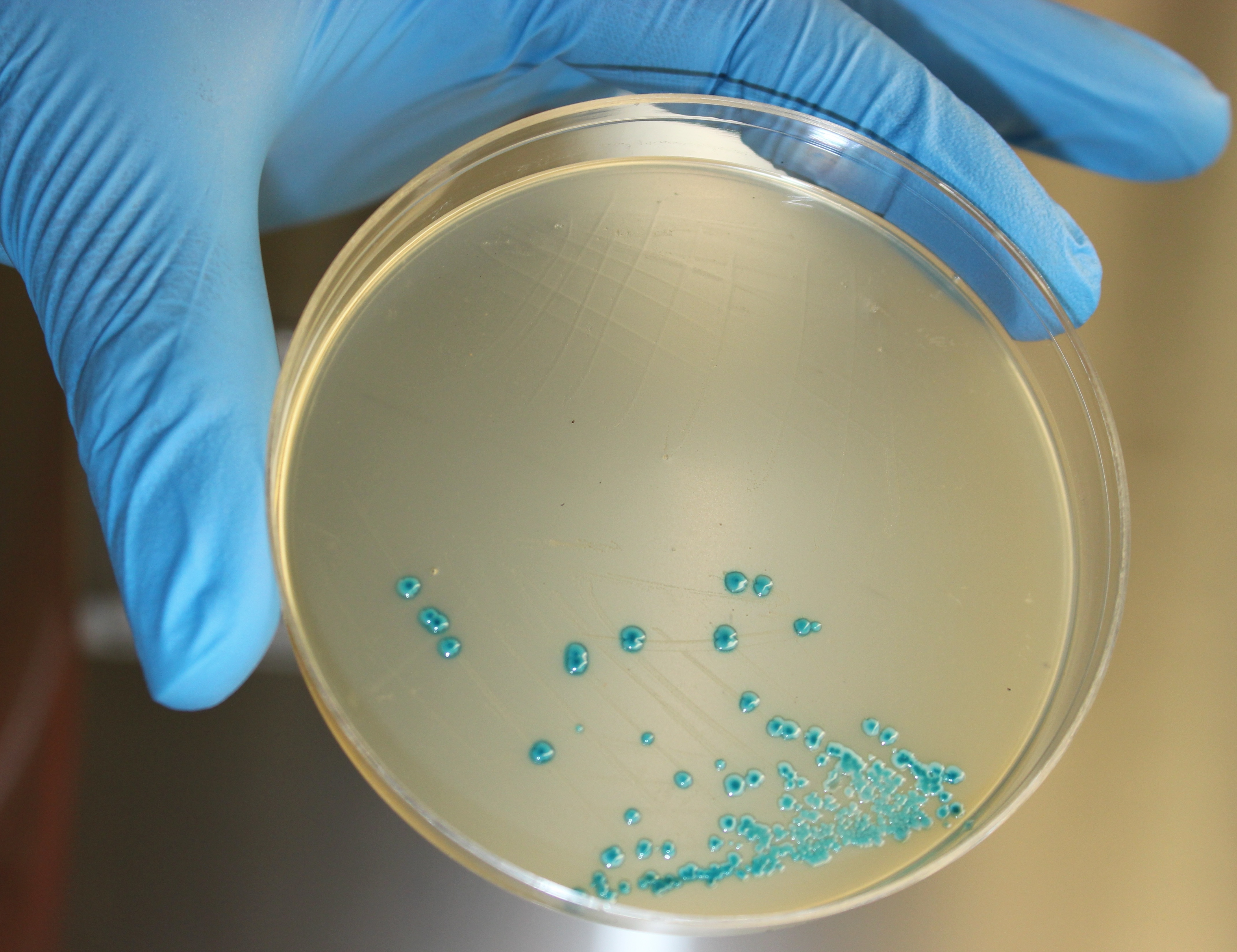 Listeria Culture